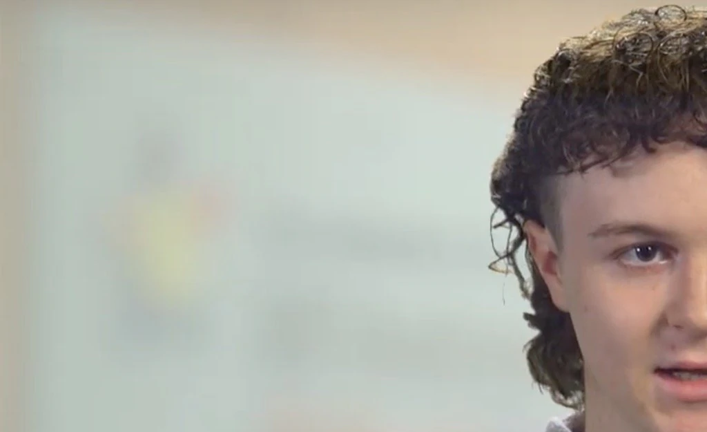 Teen is diagnosed with Stage 3 Melanoma after 'doctors dismissed symptom as sign of puberty'