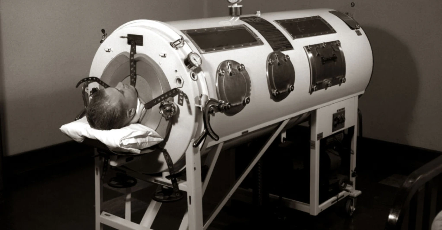 How it was possible for Paul Alexander to survive inside iron lung for 70 years